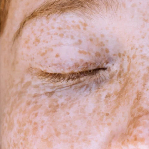 Close-up van gezicht met Veloura Vitamin C Serum op de huid, voor pigmentenvlekken en stralende huid.